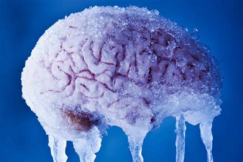 Read More. . Brain freeze feeling in head without eating something cold